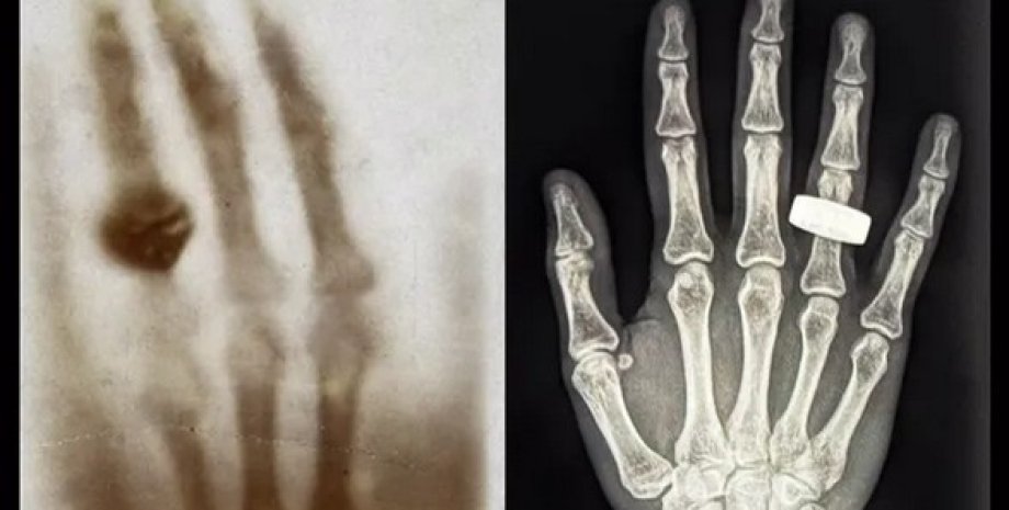 перший рентгенівський знімок людини в космосі перший рентгенівський знімок людини в космосі