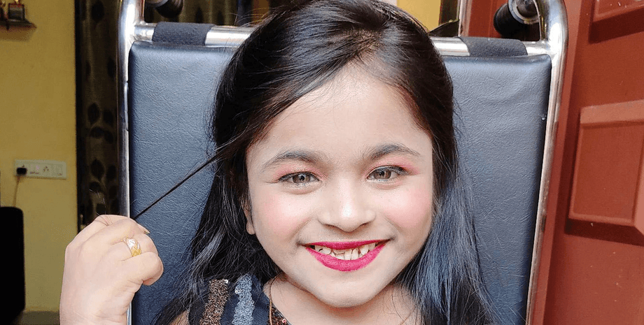 Дівчина з рідкісним захворюванням, дівчина, схожа на дитину, деформація кісток, співачка