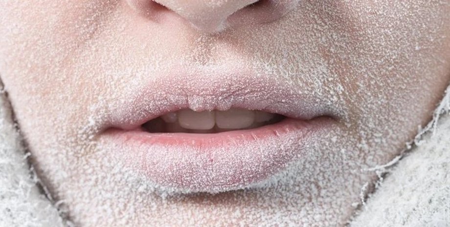 респираторные заболевания, мороз простуда, морозы грипп