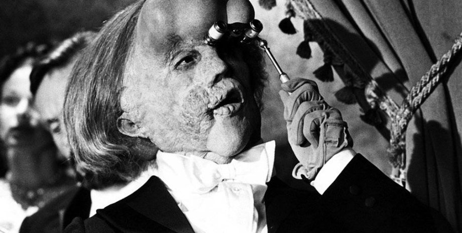 Кадр из фильма Дэвида Линча "Человек-слон"