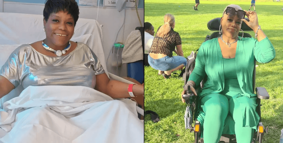 Жінка після інсульту, лікарі були шоковані, почала говорити з італійським акцентом, рідкісний випадок, акцент змінився, змінилася манера поведінки