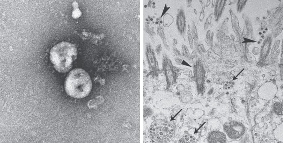 Частицы коронавируса 2019-nCoV. Фото: The New England Journal of Medicine