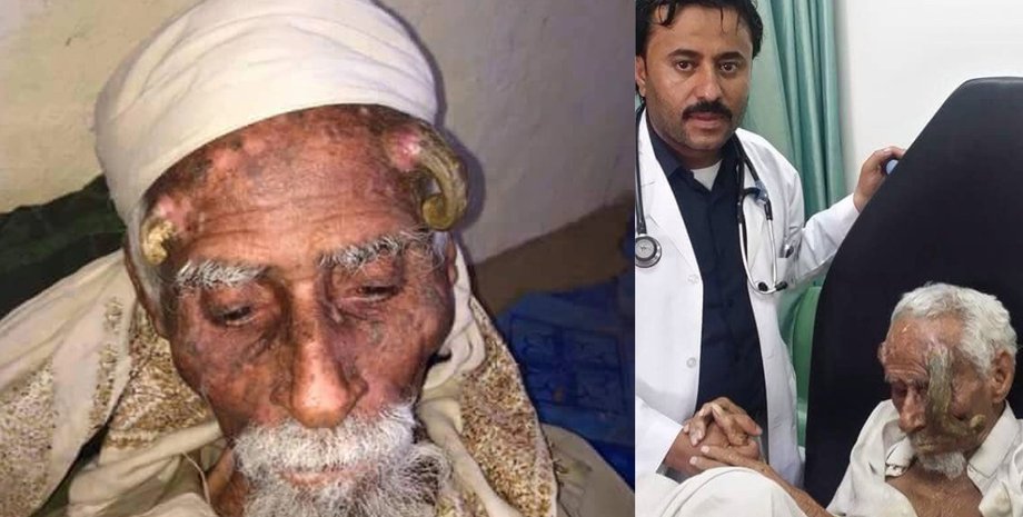 Старик, доктор, мужчина, рога, нарост,