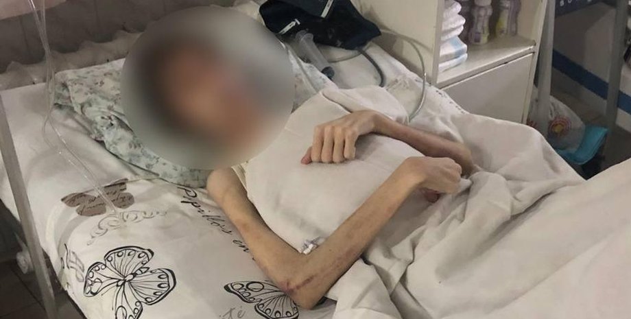 Одесса, подросток, истощение,