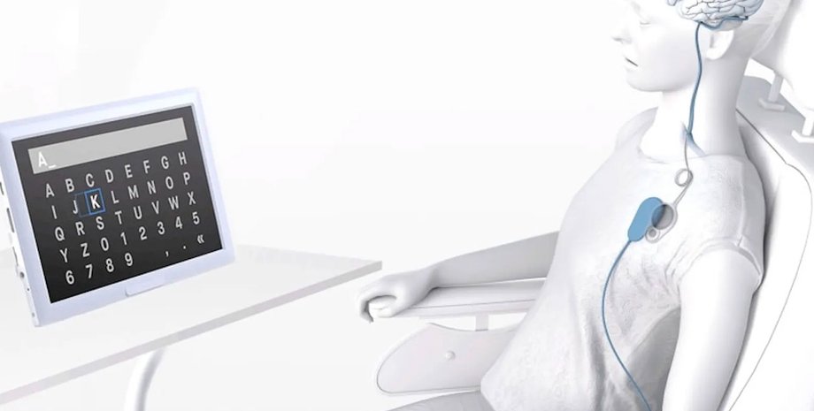 Synchron Switch, датчик, сенсор, имплант