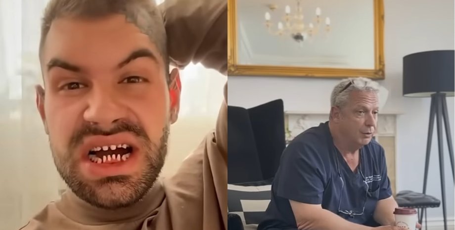 Мужчина демонстрирует подпиленные зубы после подготовки к винирам, рядом стоматолог объясняет риски