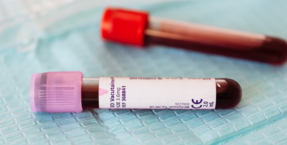 лечение, анализ крови, США, профилактика заболеваний, сифилис, краснуха, брачные правила, общественное здоровье, сексуальное здоровье, обязательный анализ крови, история болезни, глобальная перспектива, история