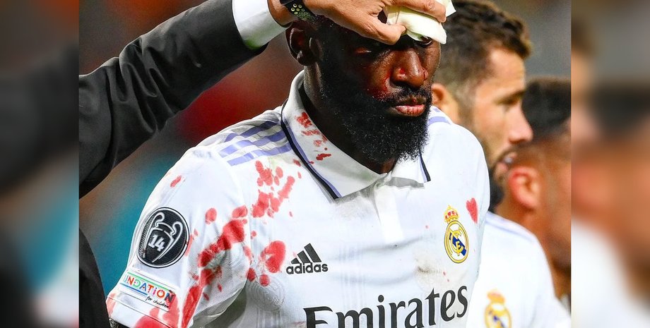 Антоніо Рюдігер у матчі проти "Шахтаря"., Антоніо Рюдігер травма