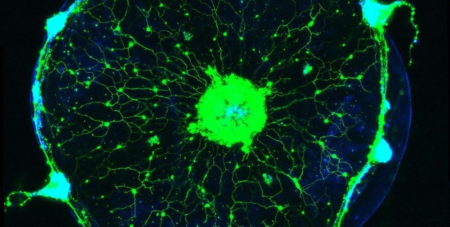 медуза, свечение, флуоресценция, фото