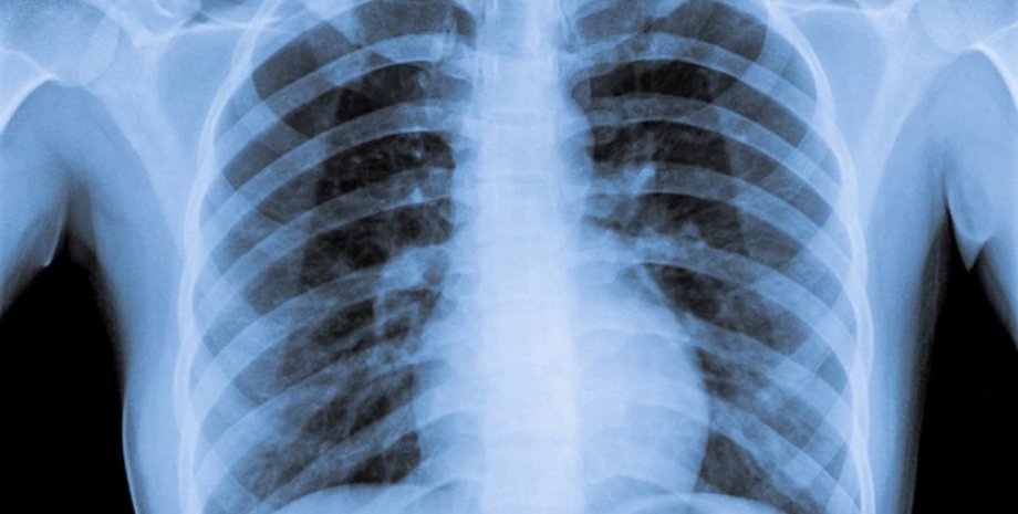 курильщик, курение, коронавирус