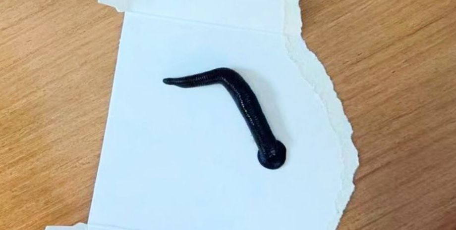 В організмі хлопчика жила жива п'явка завдовжки 12 сантиметрів, як це можливо, неймовірні історії з життя