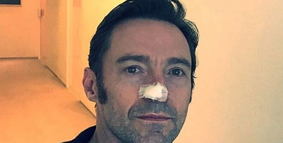 Хью Джекман / Фото: Instagram