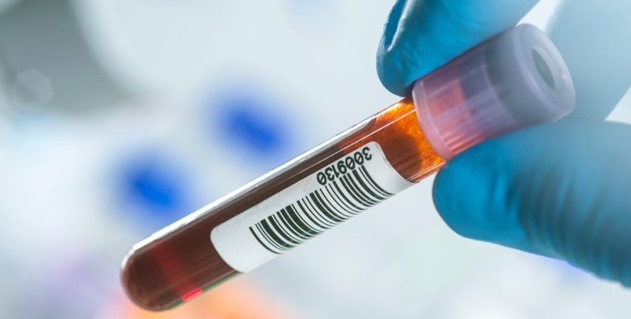 аналіз крові