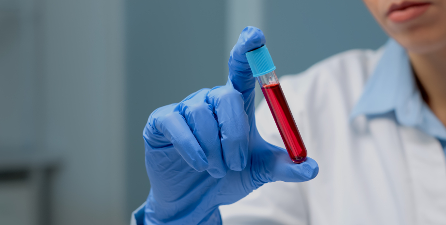 анализ крови пробирка, перчатка, тест, наука