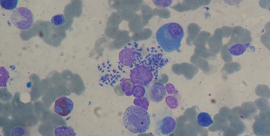 болезнь, паразит, лечение, грибок, одноклеточные, здоровье, врач, заболевание, путешествие, ковид, узел, пациент, история болезни, поражение