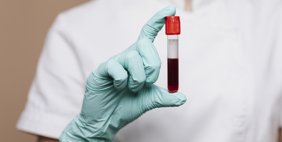 анализ крови пробирка, кровь, анализ, перчатка