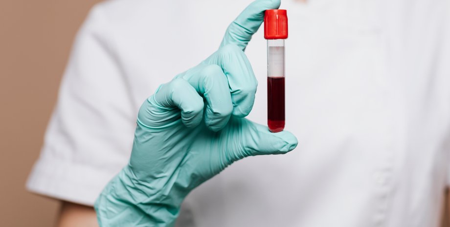 Пробирка с кровью