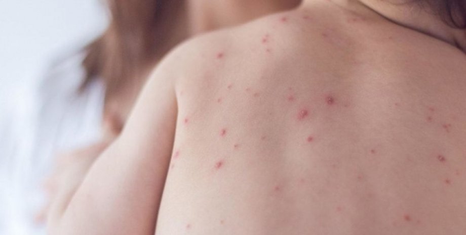 Фото: kr24.com.ua