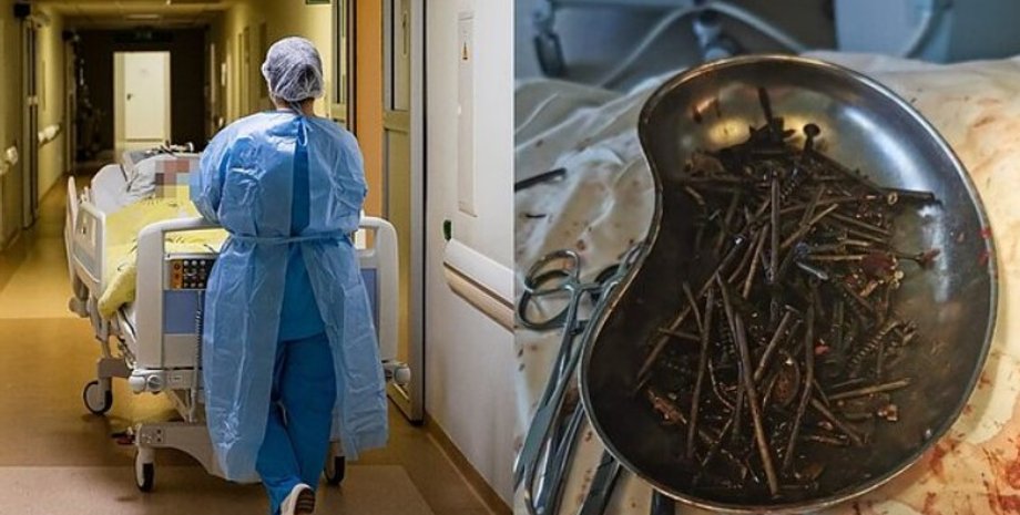 В желудке жителя Литвы обнаружили килограмм гвоздей и шурупов