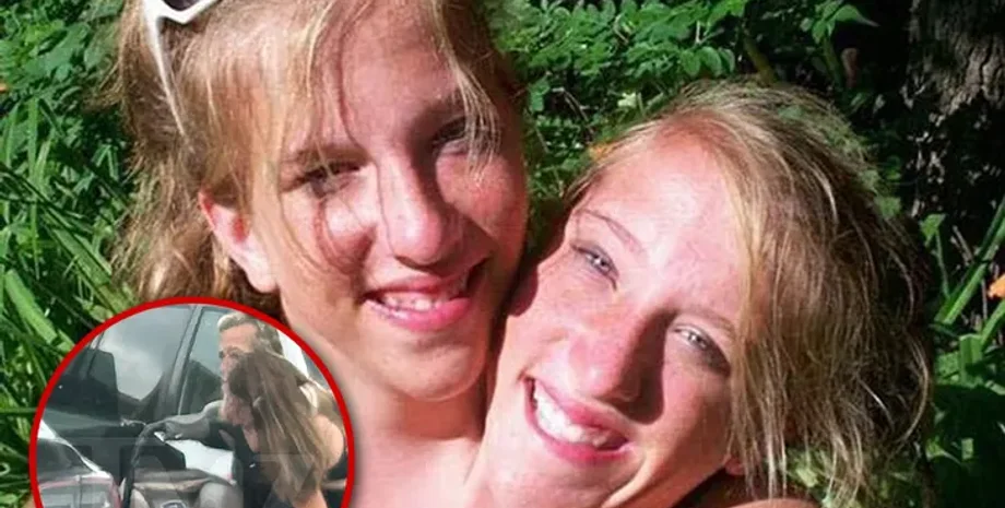 Сиамские близняшки с ребенком