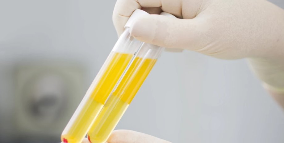 плазма, кровь, коронавирус