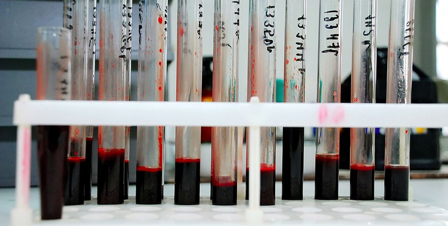 пробирки, кровь, анализы
