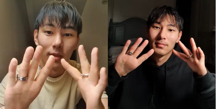 Цяо Алберс демонструє свої руки без великих пальців у різних відео