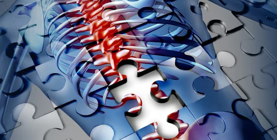 боль в спине, боль в пояснице, боль в позвоночнике