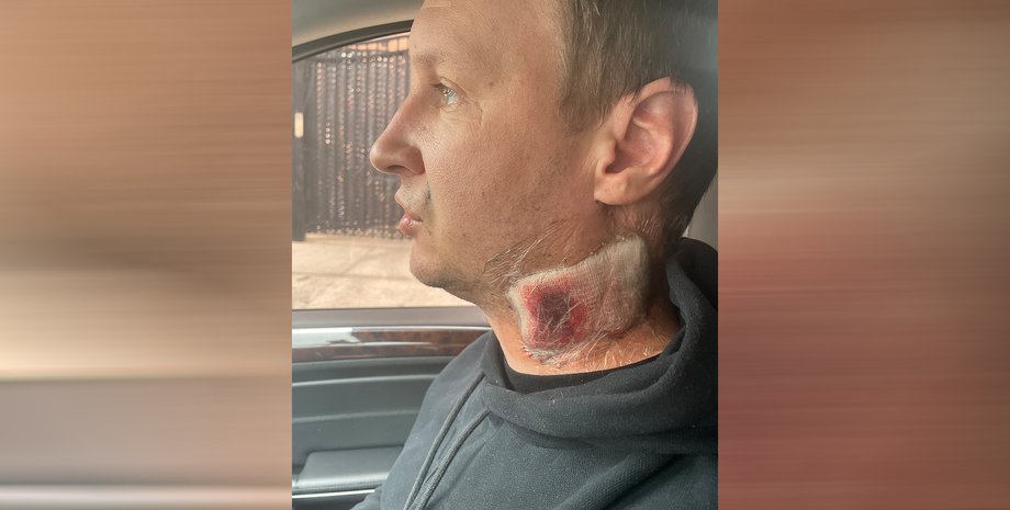 Андрей Мелешков, Андрей Мелешков нью-йорк, Андрей Мелешков запорожье, Андрей Мелешков драка