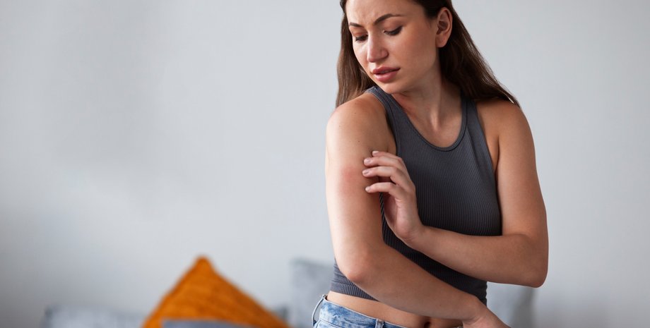 Девушку укусил комар