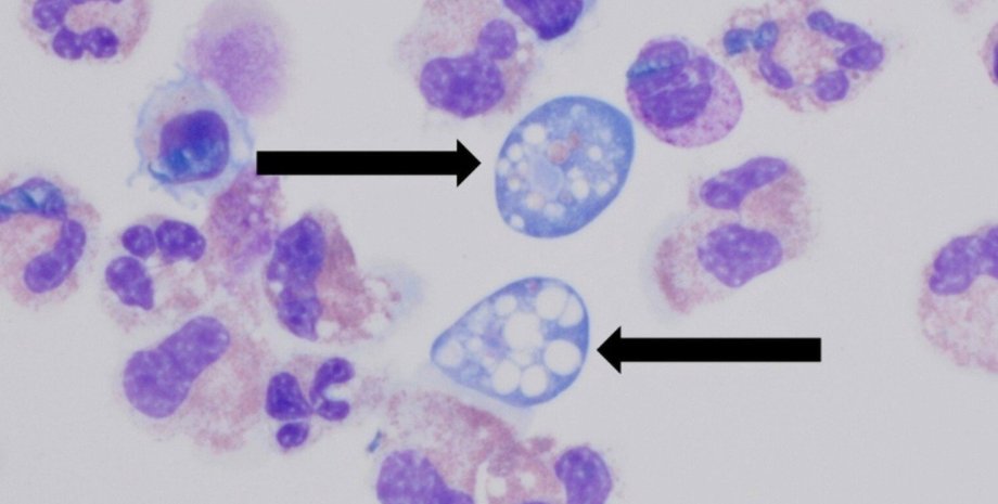 Naegleria fowleri