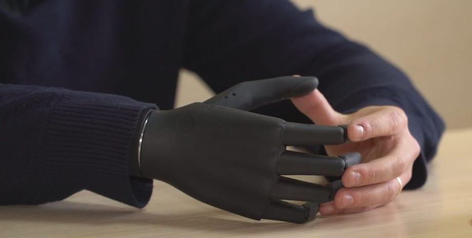 бионическая рука, бионический протез, протезирование, украина, люди с инвалидностью, ампутация