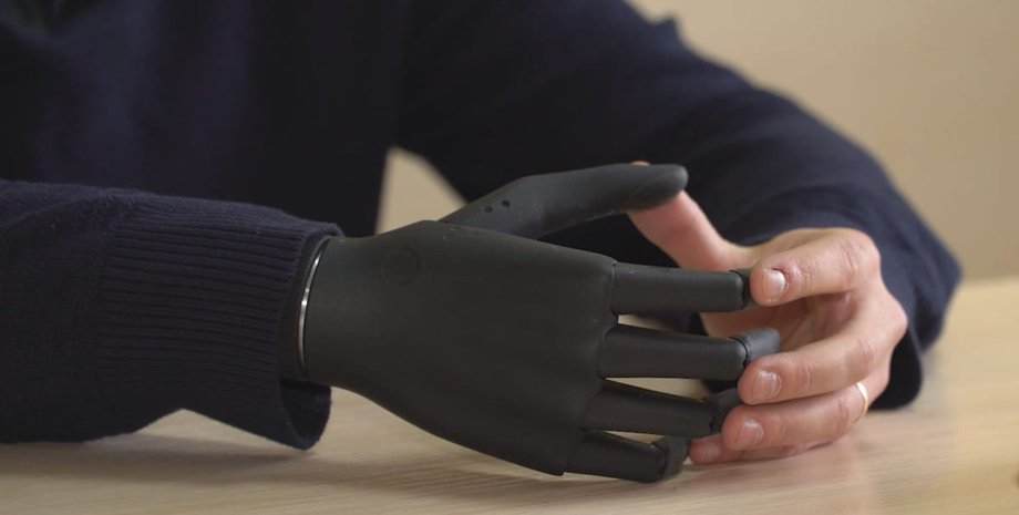 бионическая рука, бионический протез, протезирование, украина, люди с инвалидностью, ампутация