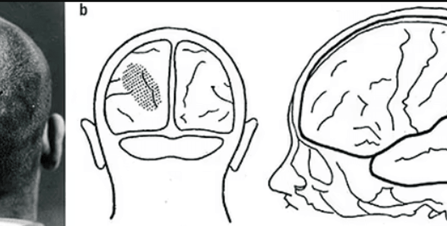 пуля, солдат, мозг