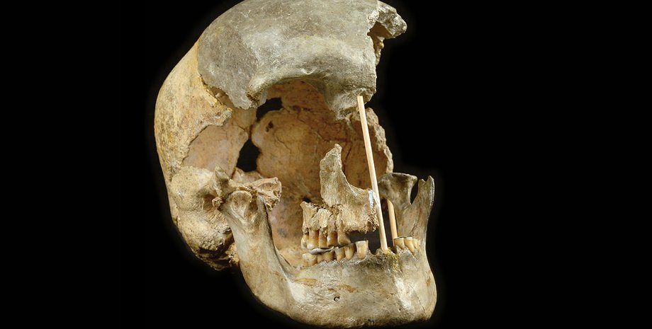 череп, останки, фото, Homo sapiens