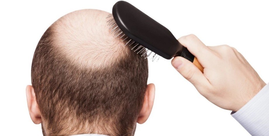 лысый мужчина