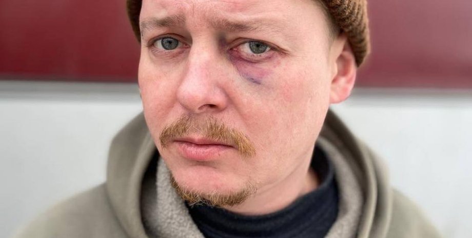 новини дніпра, новини чернігова, директор театру, актор театру, директор побив актора