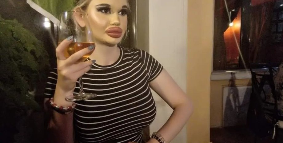 Косметические операции, Косметические операции последствия, увеличение губ, увеличение губ последствия, Андреа Иванова Болгария, Андреа Иванова губы, Андреа Иванова операции