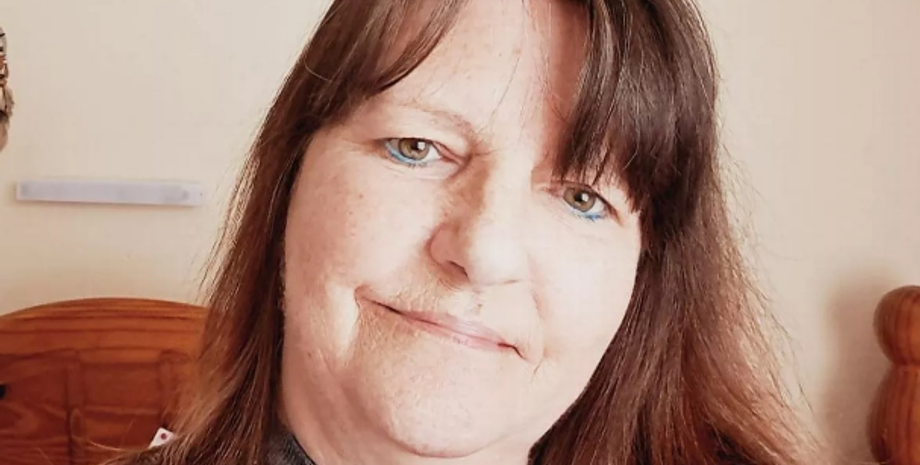 Стоматология, вырвать зуб, медицина, курьезы, цены на зубы, Великобритания, фото, пациентка, скандал