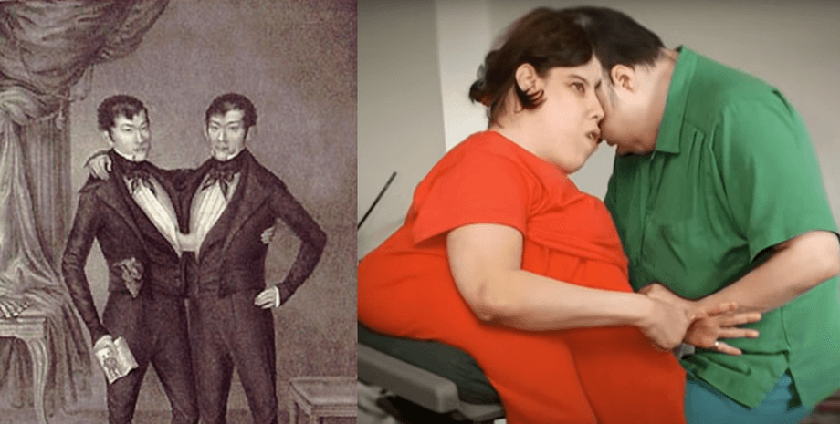 Сіамські близнюки історії