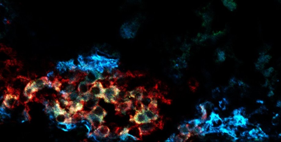 клетки, поджелудочная железа, бета-клетки