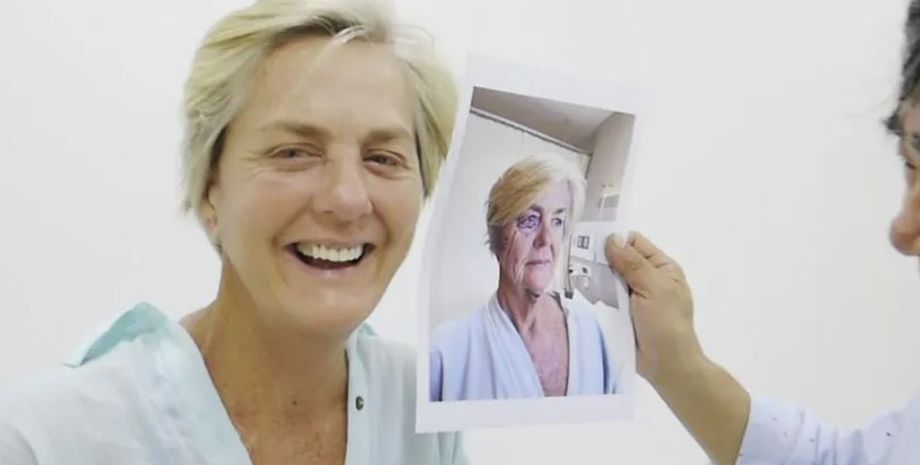 Как сохранить молодость, омоложение, красота, внешность, до и после пластической операции