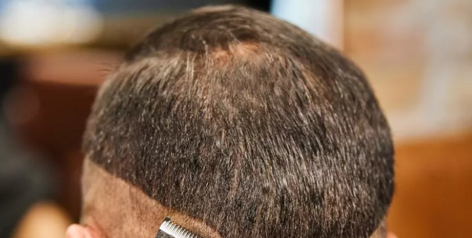 Чоловічі зачіски, щоб приховати залисини, фото до та після