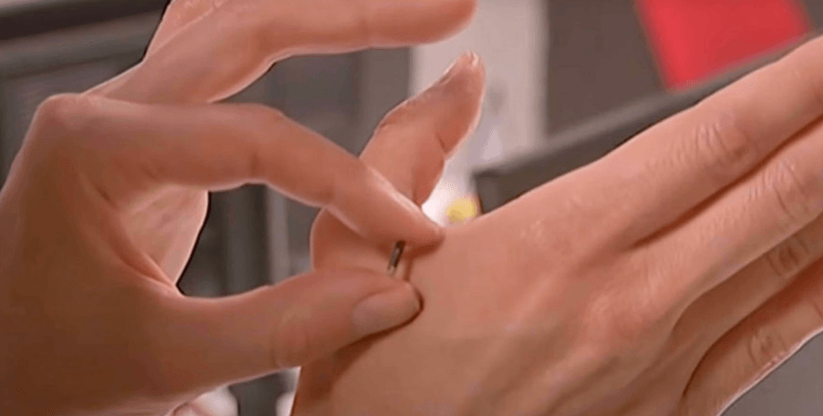 Чипирование собак, чипирование животных, чип, микрочип, сканирование чипа, мама вживила в дочь микрочип