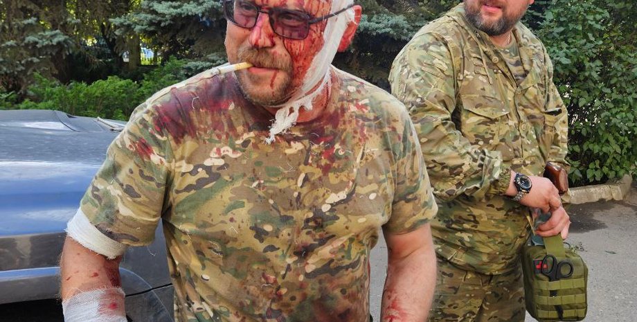 Бородай дістав серйозні поранення