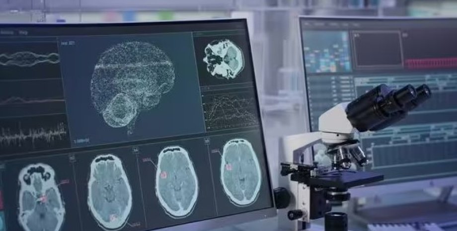 мозок мозок