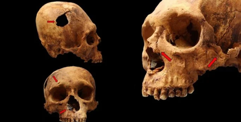 череп культура, Перу, Анды, Чавин, ученые, цивилизация, упадок, конкуренция, ресурсы, скелет, захоронение, конфликт, нападение, война, кости, насилие, взрослые, дети, череп, перелом, рана, жертвы, убийство