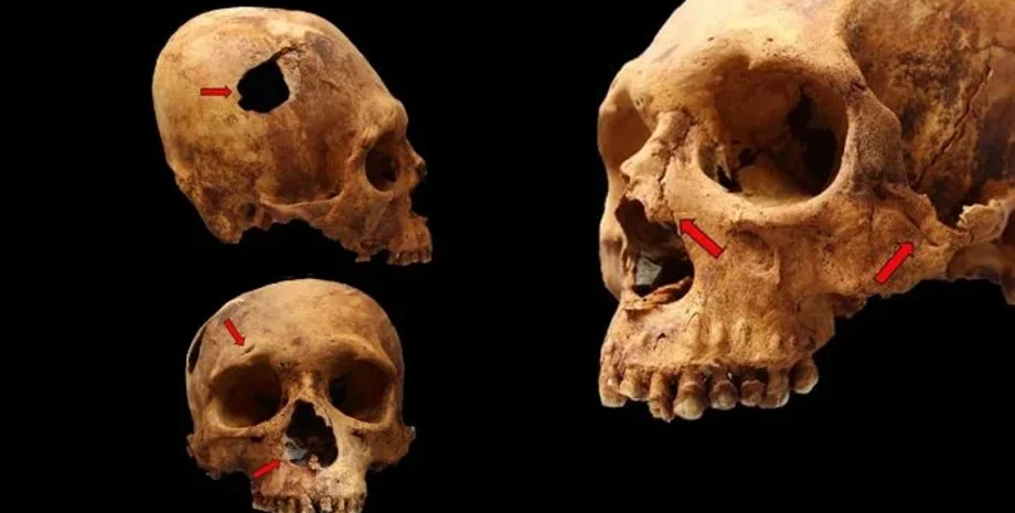 культура, Перу, Анди, Чавін, вчені, цивілізація, занепад, конкуренція, ресурси, скелет, поховання, конфлікт, напад, війна, кістки, насильство, дорослі, діти, череп, перелом, рана, жертви, вбивство