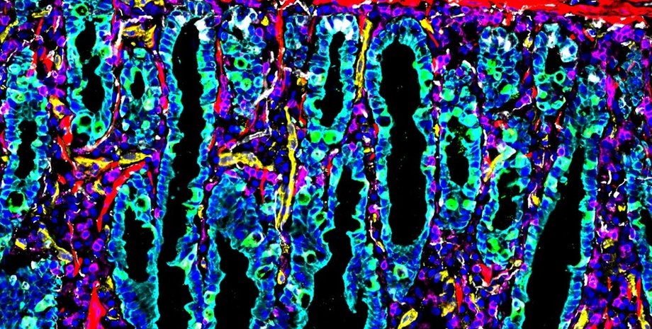 кишечник человека, кишечник человека карта