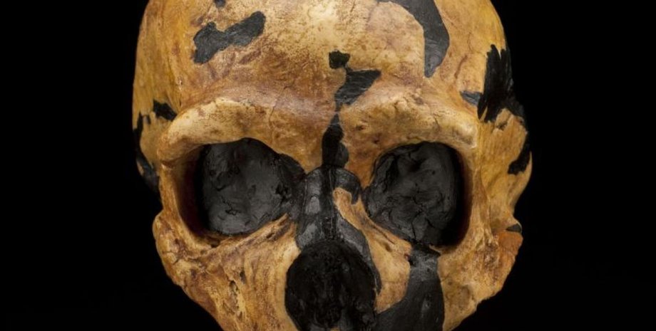 Недавнє дослідження пролило світло на рідкісне захворювання мозку